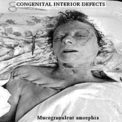 Congenital Interior Defects : Mucogranulent Amorphia